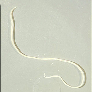 Case301_B.jpg Figure B