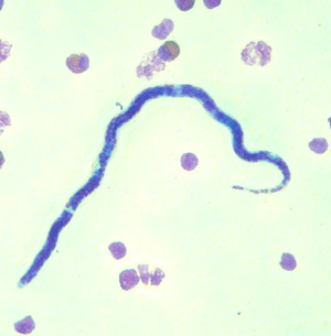 Case301_D.jpg Figure D