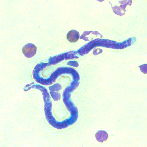 Case301_E.jpg Figure E