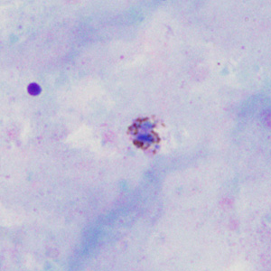 Case302_B.jpg Figure B