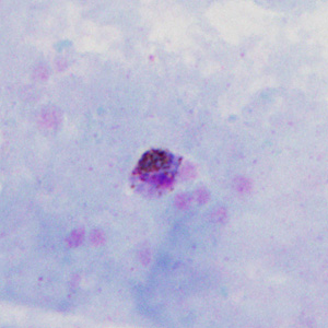 Case302_C.jpg Figure C