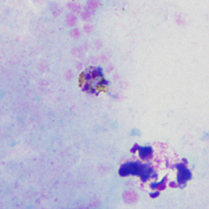 Case302_D.jpg Figure D