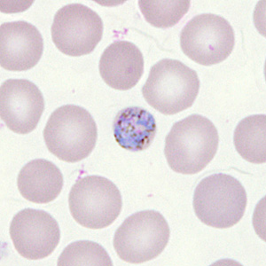 Case302_E.jpg Figure E