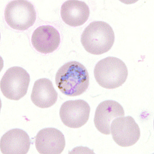 Case302_F.jpg Figure F