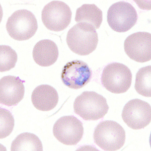 Case302_G.jpg Figure G