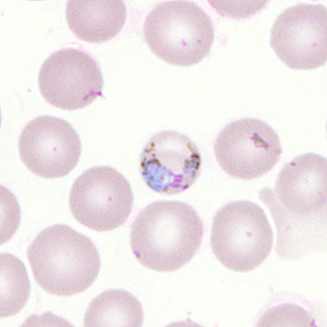 Case302_H.jpg Figure H