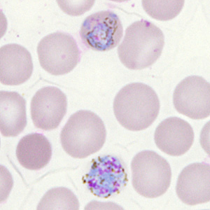 Case302_I.jpg Figure I