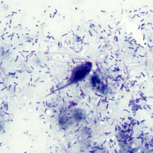 Case303_B.jpg Figure B