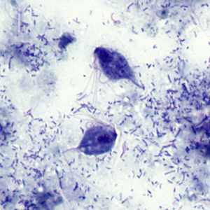 Case303_D.jpg Figure D