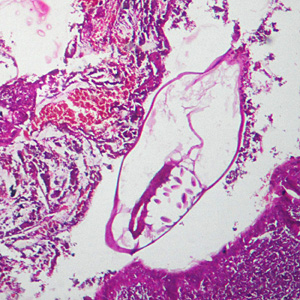 Figure B