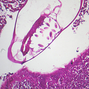 Figure C