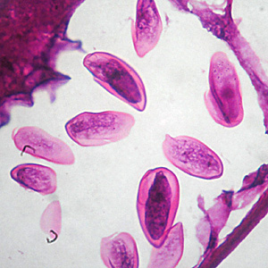 Case305_D.jpg Figure D