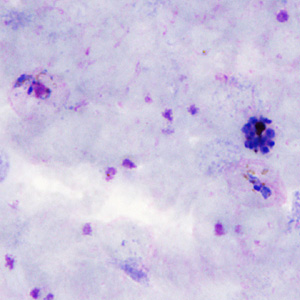 Case306_B.jpg Figure B