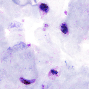 Case306_C.jpg Figure C