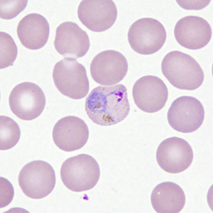 Case306_D.jpg Figure D