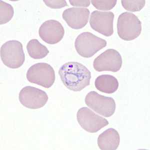 Case306_E.jpg Figure E