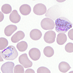 Case306_F.jpg Figure F