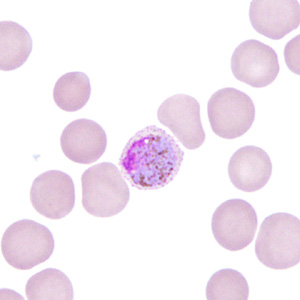 Case306_G.jpg Figure G