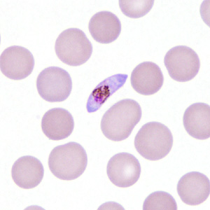 Case306_H.jpg Figure H