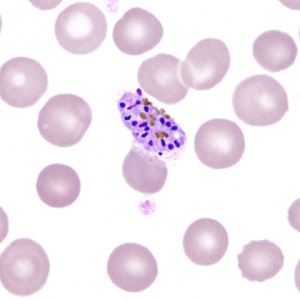 Case306_I.jpg Figure I