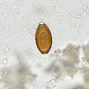 Case307_B.jpg Figure B