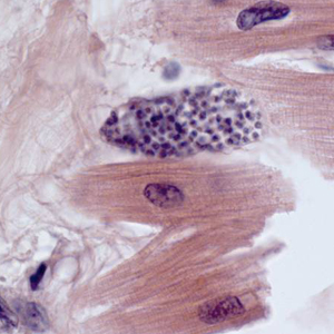 Case308_B.jpg Figure B