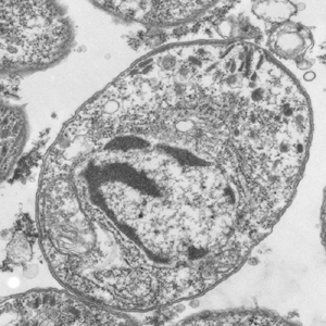 Case308_F.jpg Figure F