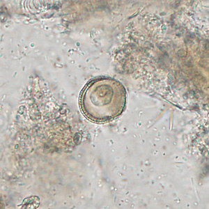 A 19-year-old male presented to his health care provider with moderate abdominal cramping and intermittent diarrhea that started approximately one week following a camping trip in the southeastern United States.