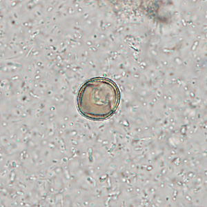 Case309_B.jpg Figure B