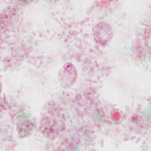 Case310_B.jpg Figure B