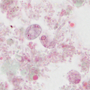 Case310_C.jpg Figure C