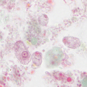 Case310_D.jpg Figure D