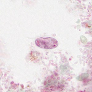 Case310_F.jpg Figure F