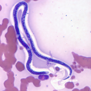 Case311_B.jpg Figure B