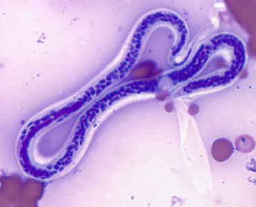 Case311_C.jpg Figure C