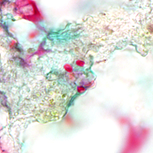 Case312_D.jpg Figure D