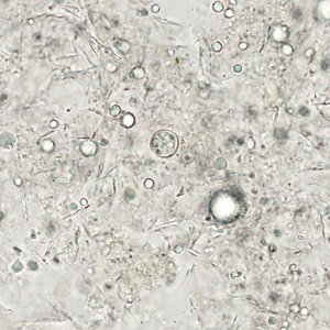 Case313_A.jpg Figure A