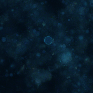 Case313_B.jpg Figure B