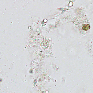 Case313_C.jpg Figure C