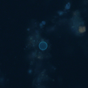 Case313_D.jpg Figure D