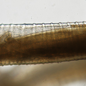 Case314_B.jpg Figure B