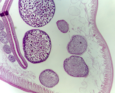 Case315_B.jpg Figure B