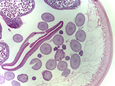 Case315_C.jpg Figure C
