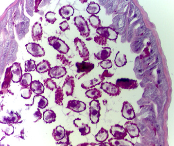 Case315_D.jpg Figure D