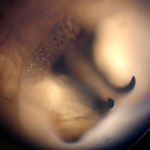 Case316_C.jpg Figure C