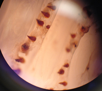 Case316_D.jpg Figure D