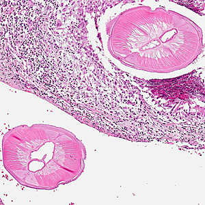 Case317_B.jpg Figure B