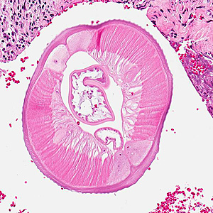 Case317_C.jpg Figure C