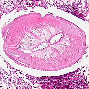 Case317_D.jpg Figure D