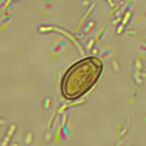 A patient with travel to Mexico presented to his local public health facility with general abdominal discomfort. A stool specimen was collected and processed using the formalin-ethyl acetate (FEA) procedure. 
